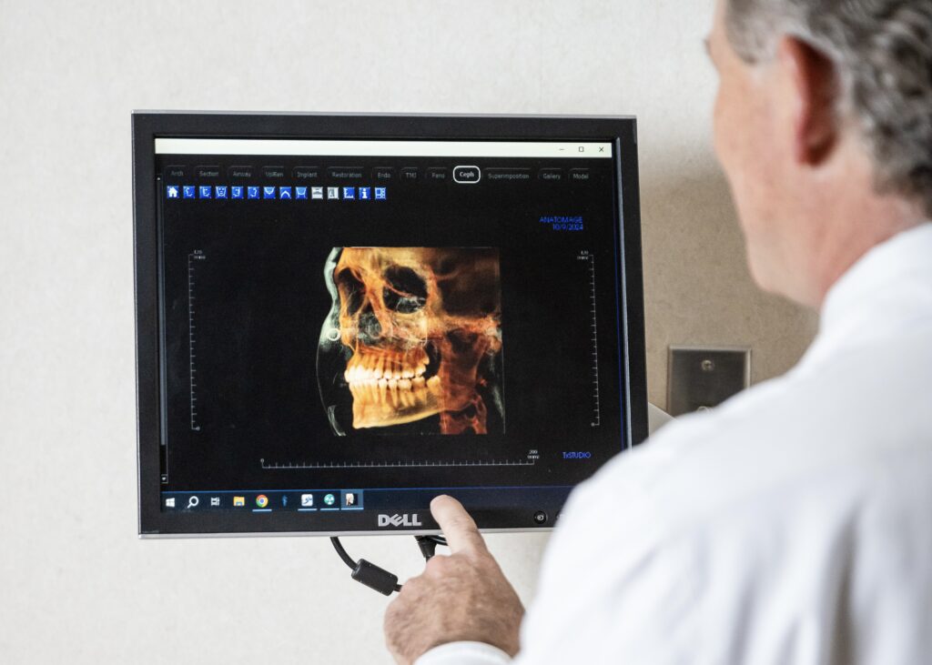 A doctor in a white coat points to a computer screen showing a 3D image of a human skull.