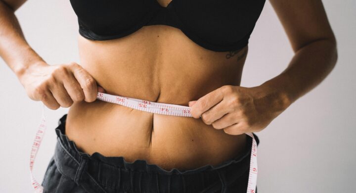 Woman holds measuring tape around her waist, depicting weight loss and excess skin.